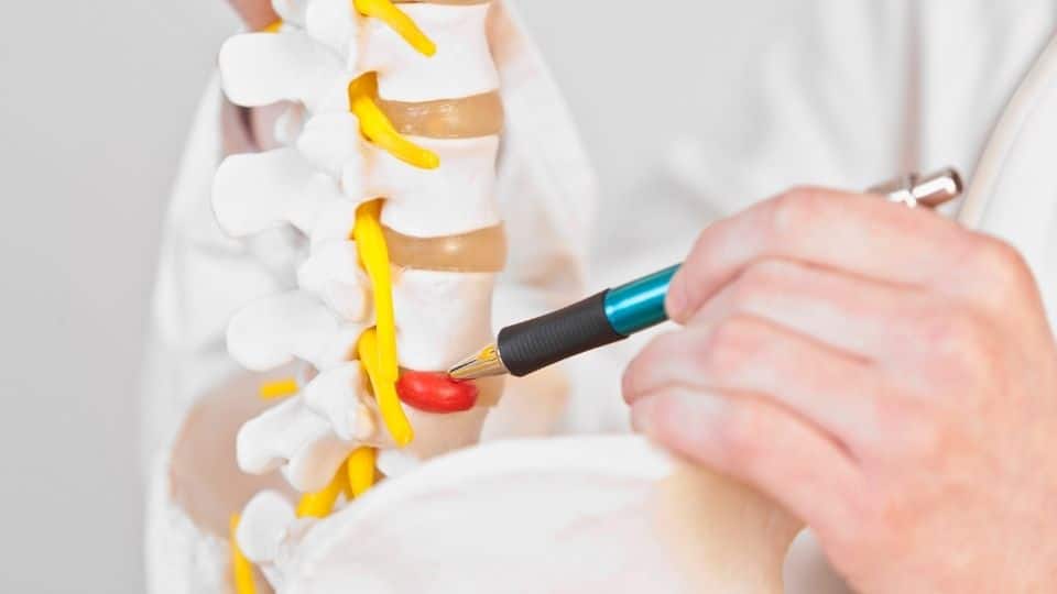 herniated disc model