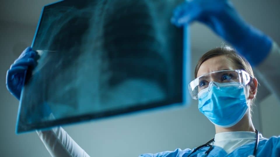 thoracic xray spinal decompression