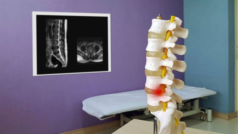 back pain treatment