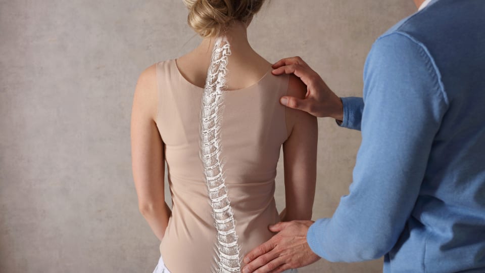 scoliosis25